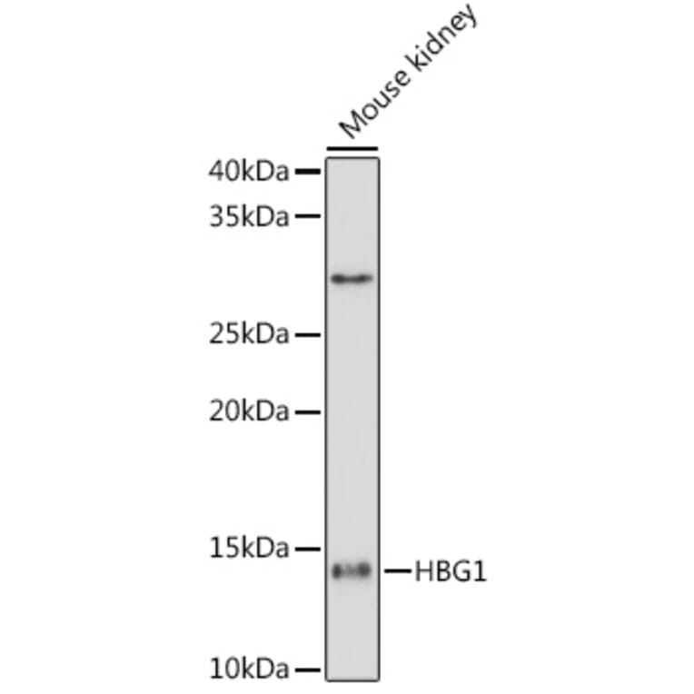 Western Blot - Anti-Fetal Hemoglobin Antibody [ARC1838] (A307354) - Antibodies.com
