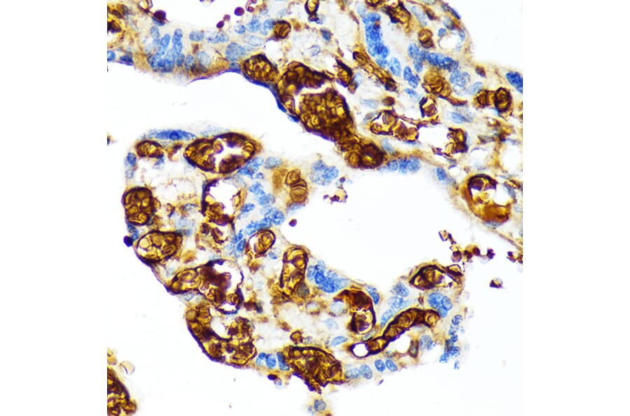 Immunohistochemistry - Anti-Fetal Hemoglobin Antibody [ARC1838] (A307354) - Antibodies.com