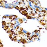 Immunohistochemistry - Anti-Fetal Hemoglobin Antibody [ARC1838] (A307354) - Antibodies.com