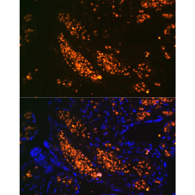 Immunofluorescence - Anti-Fetal Hemoglobin Antibody [ARC1838] (A307354) - Antibodies.com