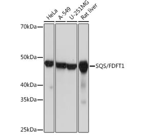 Western Blot - Anti-FDFT1 Antibody [ARC1077] (A307356) - Antibodies.com