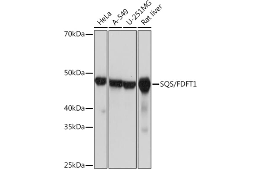 Western Blot - Anti-FDFT1 Antibody [ARC1077] (A307356) - Antibodies.com