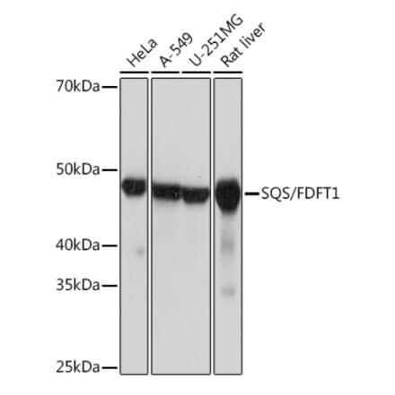 Western Blot - Anti-FDFT1 Antibody [ARC1077] (A307356) - Antibodies.com