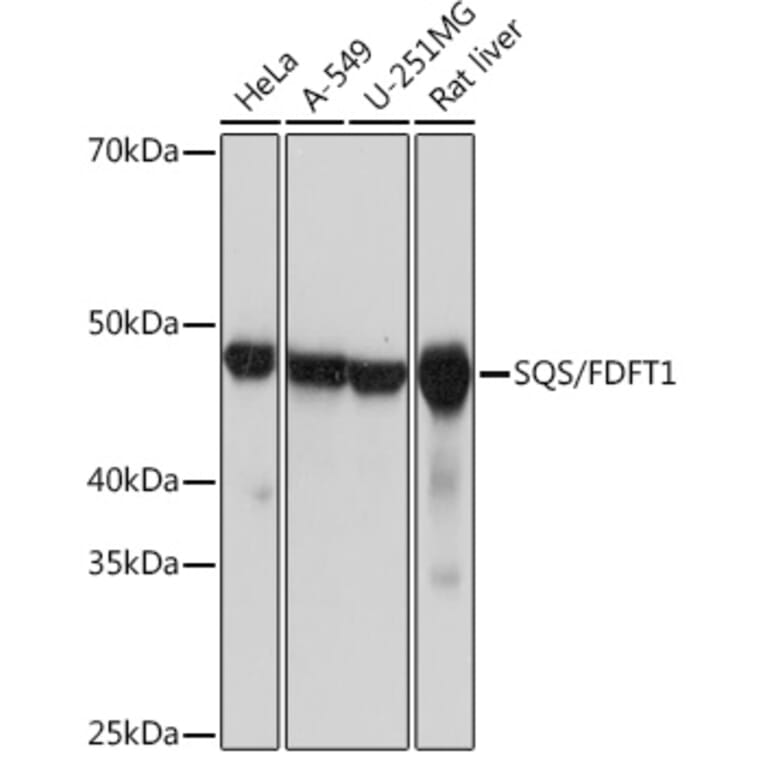 Western Blot - Anti-FDFT1 Antibody [ARC1077] (A307356) - Antibodies.com