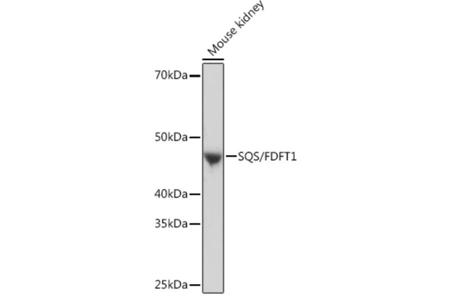 Western Blot - Anti-FDFT1 Antibody [ARC1077] (A307356) - Antibodies.com