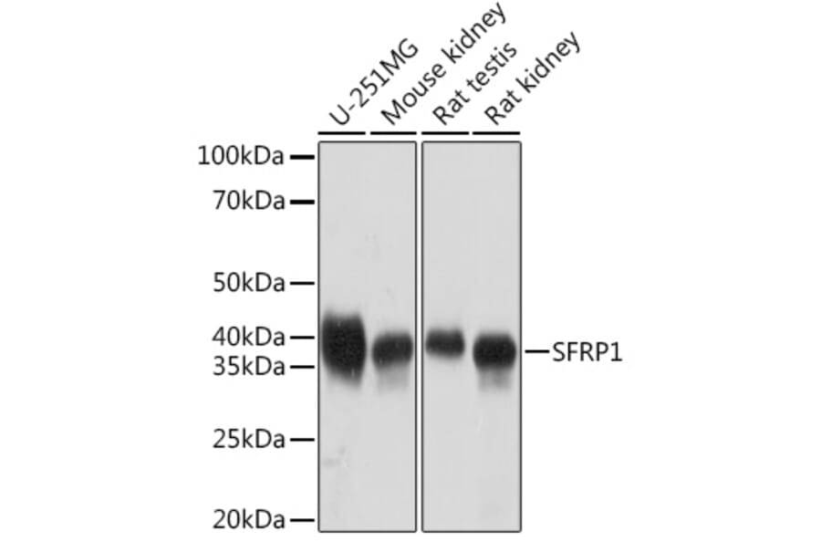 Western Blot - Anti-SFRP1 Antibody [ARC1683] (A307357) - Antibodies.com