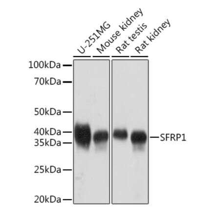 Western Blot - Anti-SFRP1 Antibody [ARC1683] (A307357) - Antibodies.com