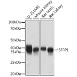 Western Blot - Anti-SFRP1 Antibody [ARC1683] (A307357) - Antibodies.com