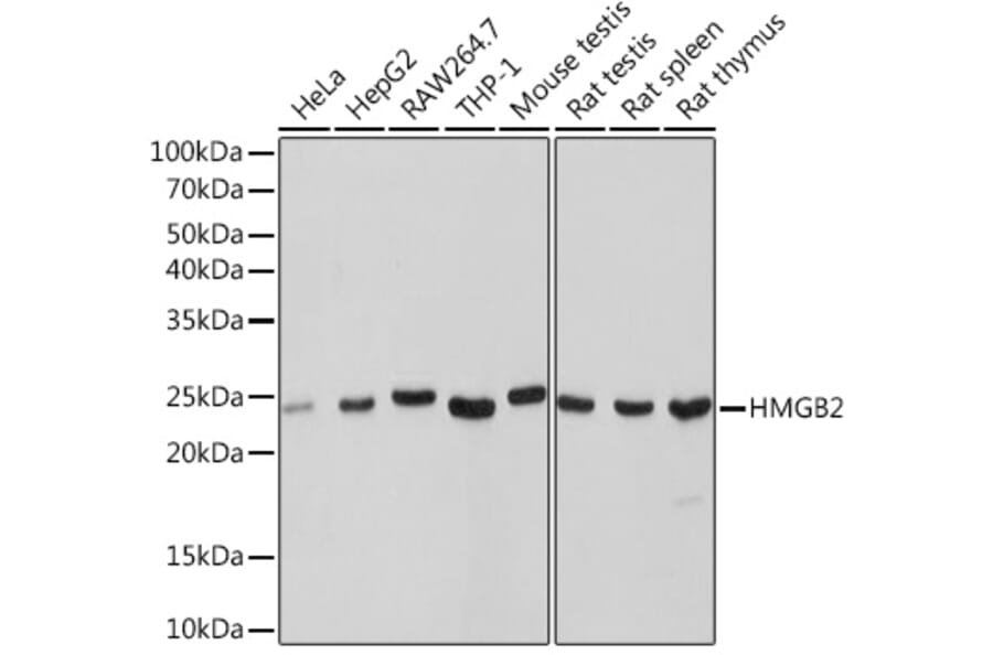 Western Blot - Anti-HMGB2 Antibody [ARC1460] (A307358) - Antibodies.com