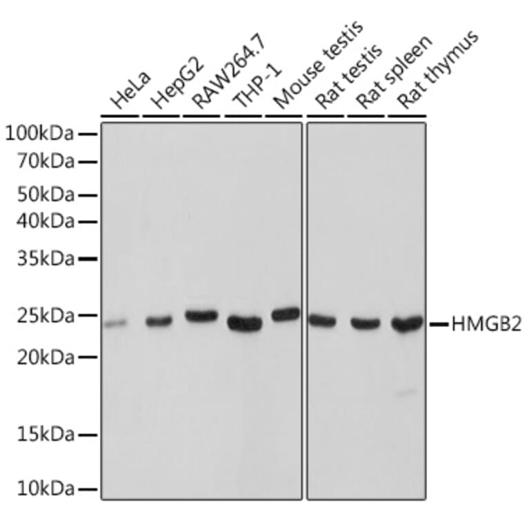 Western Blot - Anti-HMGB2 Antibody [ARC1460] (A307358) - Antibodies.com