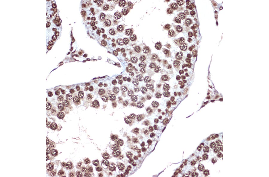 Immunohistochemistry - Anti-HMGB2 Antibody [ARC1460] (A307358) - Antibodies.com