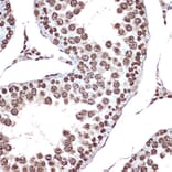 Immunohistochemistry - Anti-HMGB2 Antibody [ARC1460] (A307358) - Antibodies.com