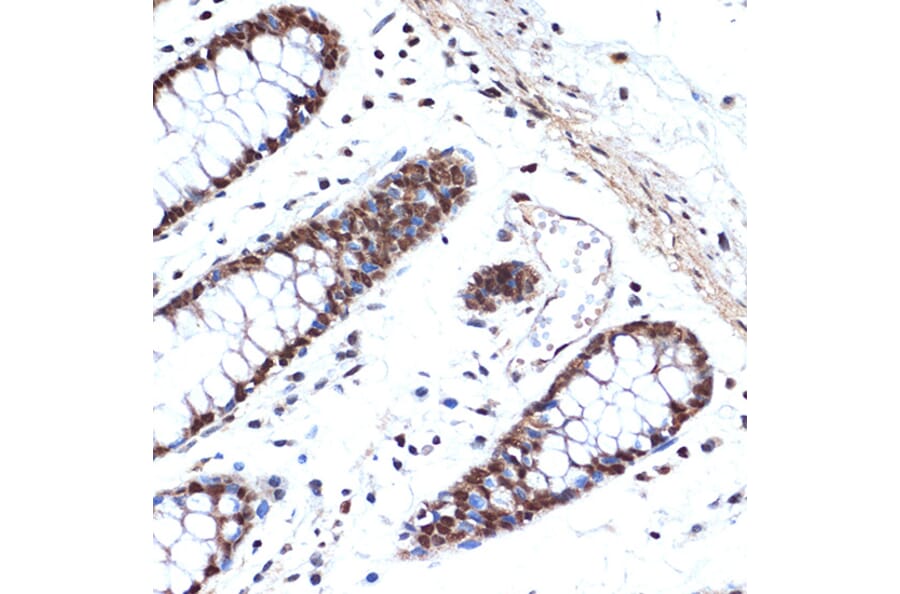 Immunohistochemistry - Anti-HMGB2 Antibody [ARC1460] (A307358) - Antibodies.com