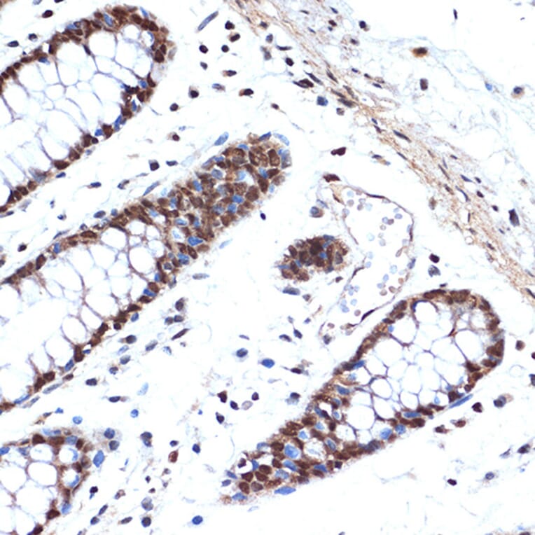 Immunohistochemistry - Anti-HMGB2 Antibody [ARC1460] (A307358) - Antibodies.com