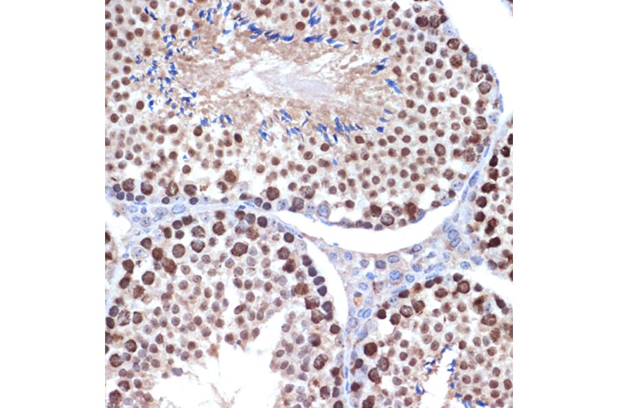 Immunohistochemistry - Anti-HMGB2 Antibody [ARC1460] (A307358) - Antibodies.com