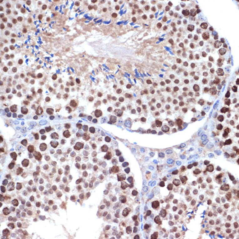 Immunohistochemistry - Anti-HMGB2 Antibody [ARC1460] (A307358) - Antibodies.com