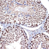 Immunohistochemistry - Anti-HMGB2 Antibody [ARC1460] (A307358) - Antibodies.com