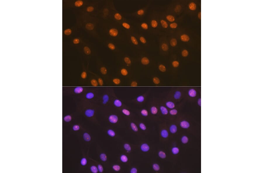 Immunofluorescence - Anti-HMGB2 Antibody [ARC1460] (A307358) - Antibodies.com