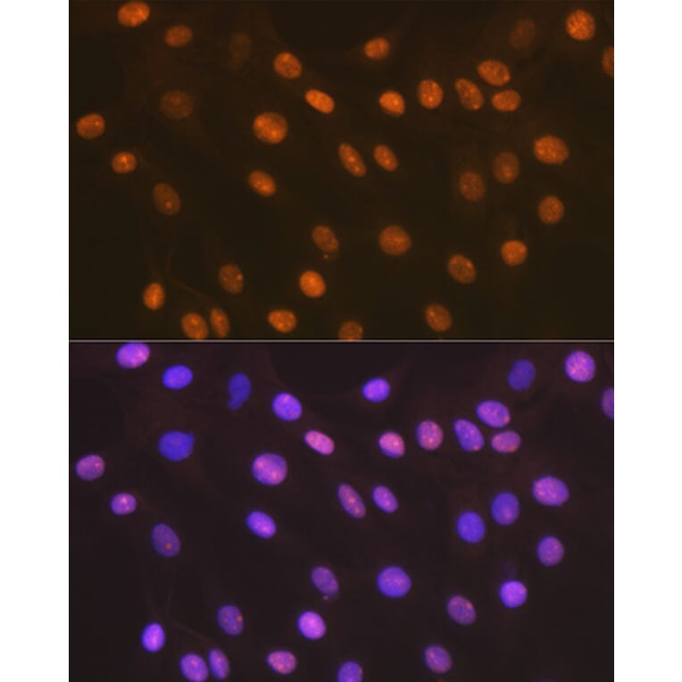 Immunofluorescence - Anti-HMGB2 Antibody [ARC1460] (A307358) - Antibodies.com