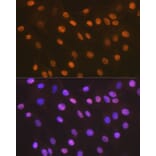 Immunofluorescence - Anti-HMGB2 Antibody [ARC1460] (A307358) - Antibodies.com