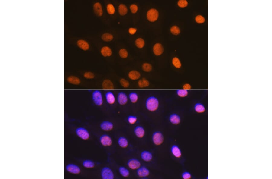 Immunofluorescence - Anti-HMGB2 Antibody [ARC1460] (A307358) - Antibodies.com
