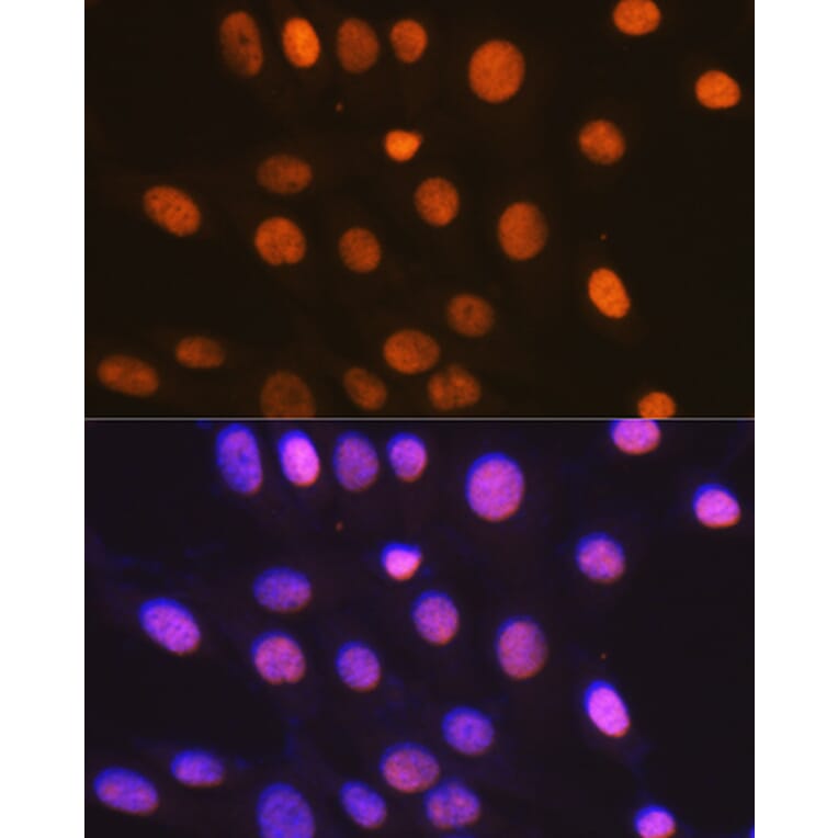 Immunofluorescence - Anti-HMGB2 Antibody [ARC1460] (A307358) - Antibodies.com