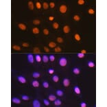 Immunofluorescence - Anti-HMGB2 Antibody [ARC1460] (A307358) - Antibodies.com