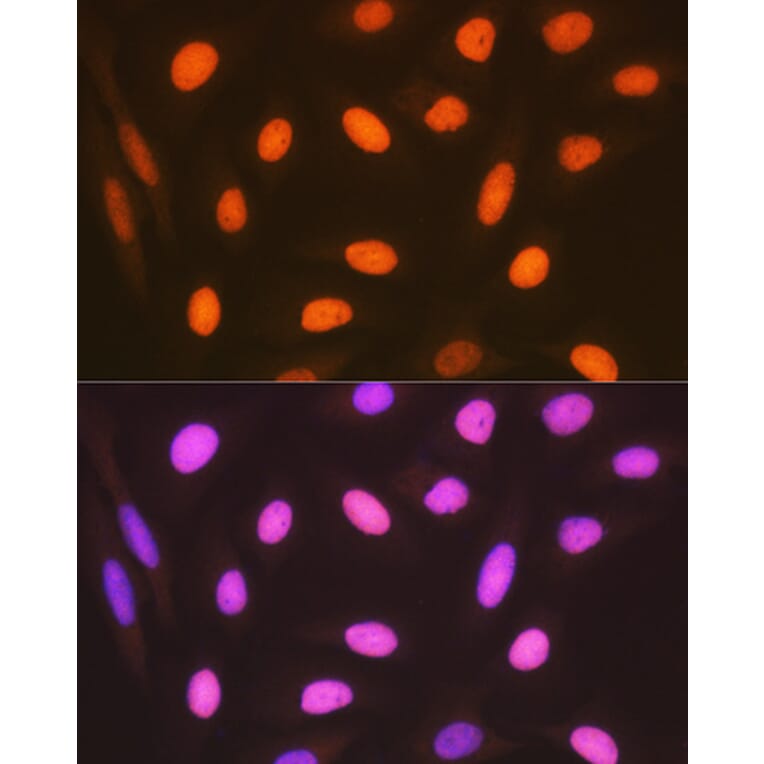 Immunofluorescence - Anti-HMGB2 Antibody [ARC1460] (A307358) - Antibodies.com