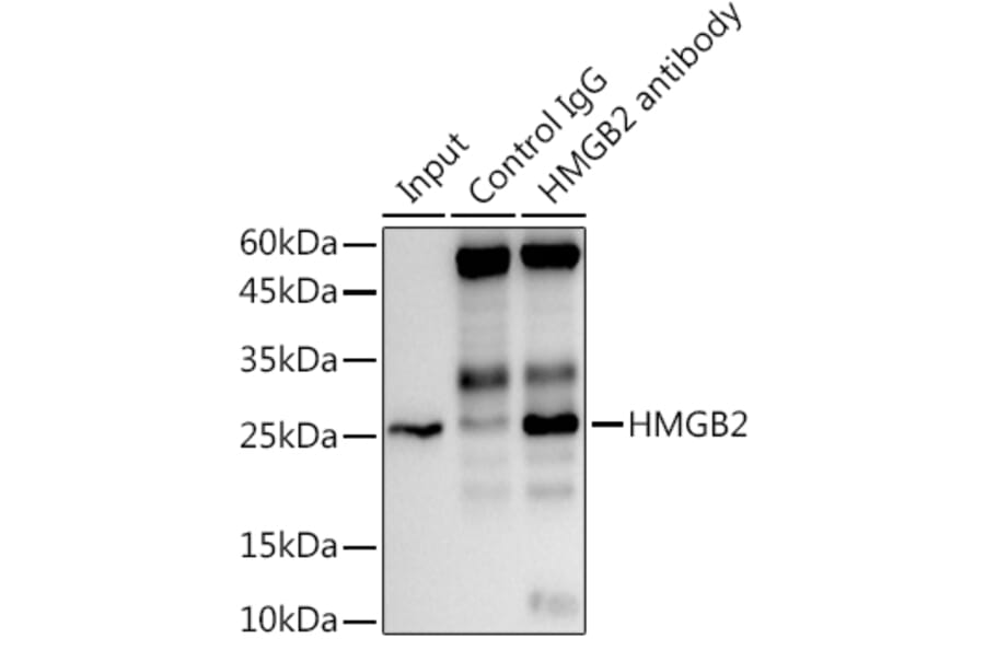 Western Blot - Anti-HMGB2 Antibody [ARC1460] (A307358) - Antibodies.com