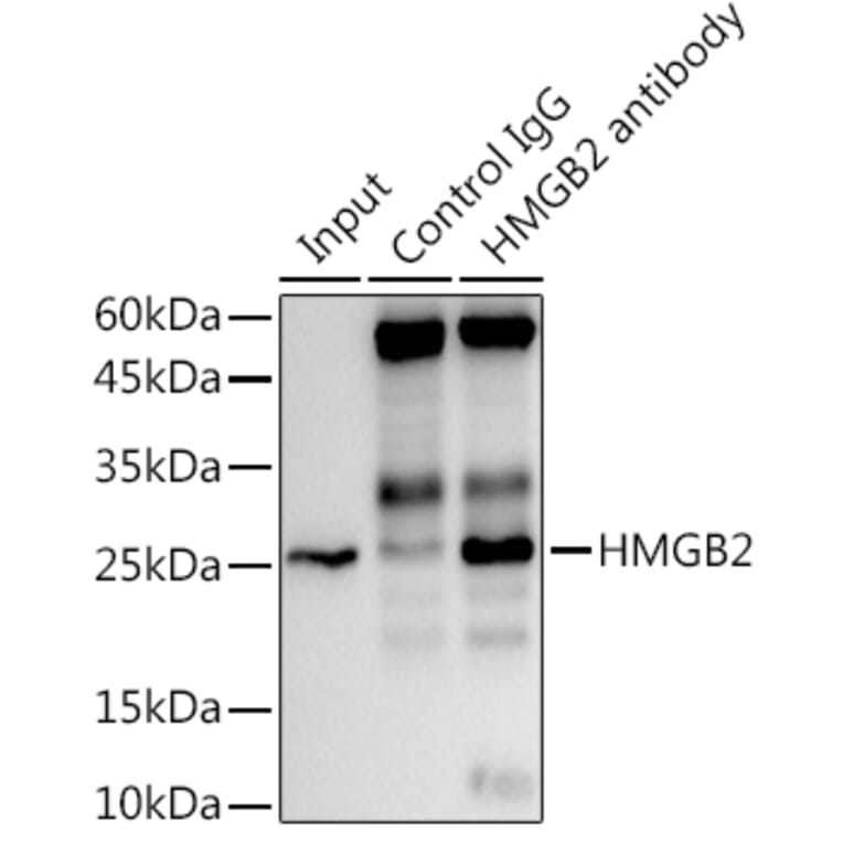 Western Blot - Anti-HMGB2 Antibody [ARC1460] (A307358) - Antibodies.com