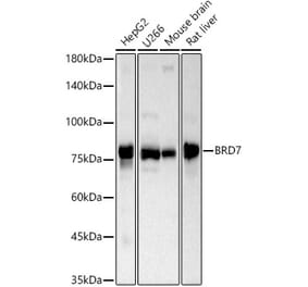 Western Blot - Anti-BRD7 Antibody (A307359) - Antibodies.com