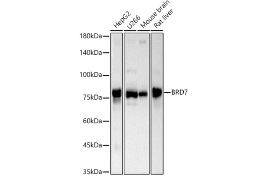 Western Blot - Anti-BRD7 Antibody (A307359) - Antibodies.com