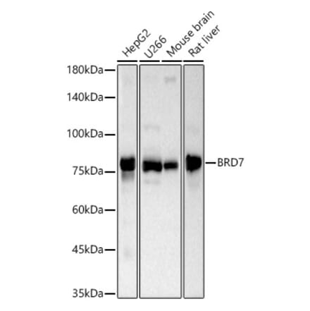 Western Blot - Anti-BRD7 Antibody (A307359) - Antibodies.com