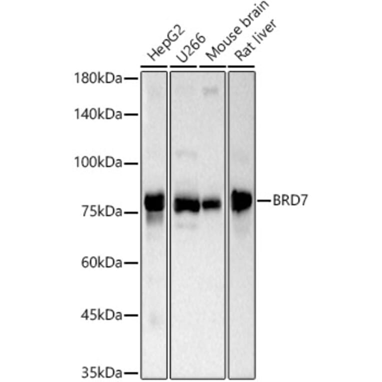 Western Blot - Anti-BRD7 Antibody (A307359) - Antibodies.com