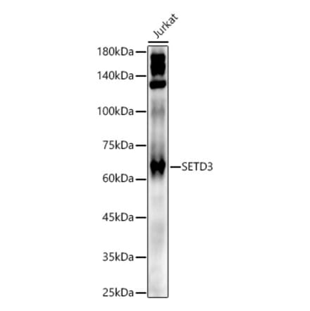 Western Blot - Anti-SETD3 Antibody (A307360) - Antibodies.com
