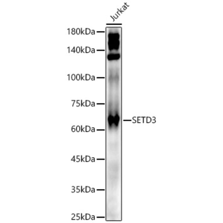 Western Blot - Anti-SETD3 Antibody (A307360) - Antibodies.com