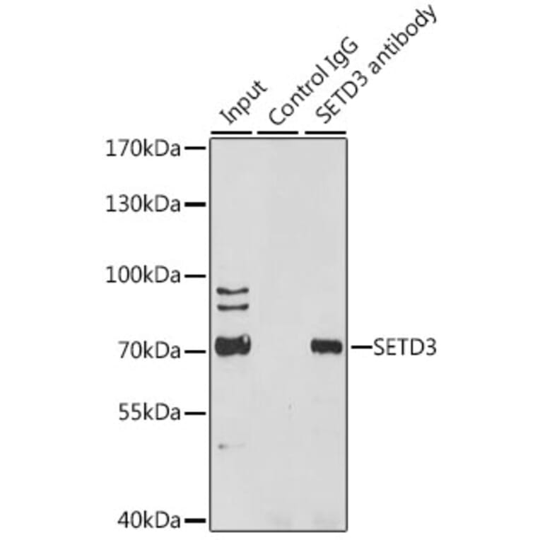 Western Blot - Anti-SETD3 Antibody (A307360) - Antibodies.com