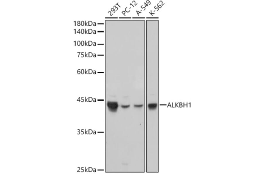 Western Blot - Anti-ALKBH1 Antibody [ARC2511] (A307362) - Antibodies.com