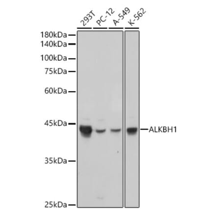 Western Blot - Anti-ALKBH1 Antibody [ARC2511] (A307362) - Antibodies.com