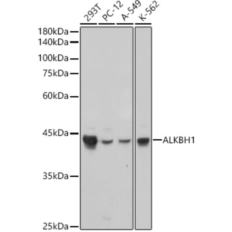 Western Blot - Anti-ALKBH1 Antibody [ARC2511] (A307362) - Antibodies.com