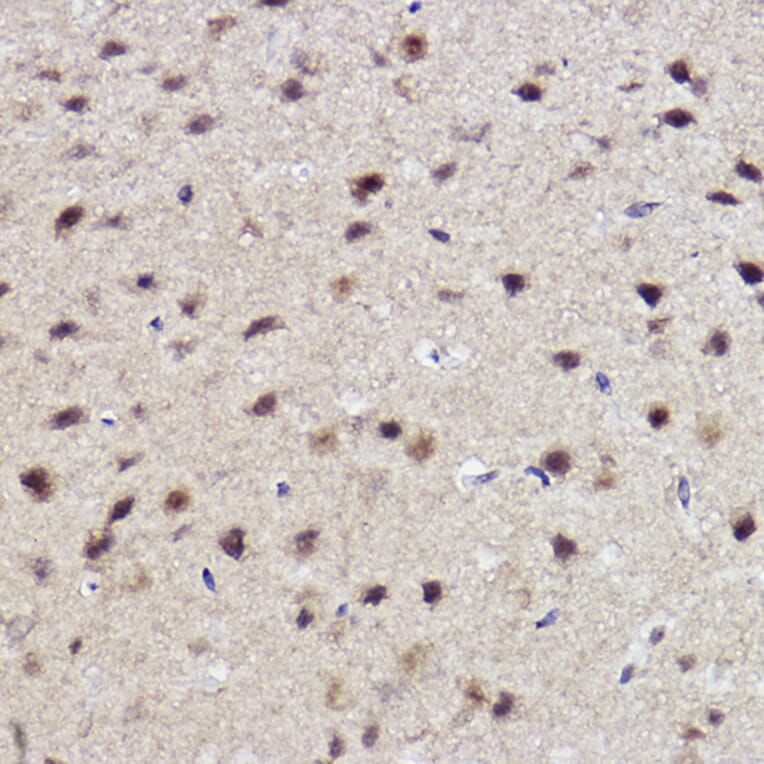 Immunohistochemistry - Anti-ALKBH1 Antibody [ARC2511] (A307362) - Antibodies.com