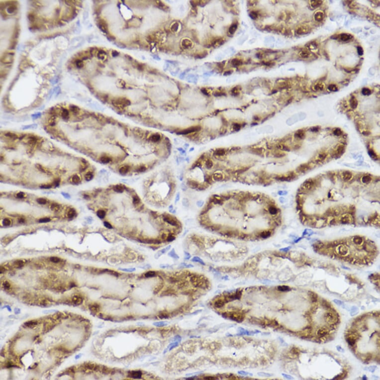 Immunohistochemistry - Anti-ALKBH1 Antibody [ARC2511] (A307362) - Antibodies.com
