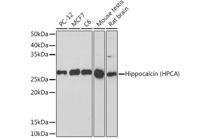 Western Blot - Anti-Hippocalcin Antibody [ARC2235] (A307363) - Antibodies.com