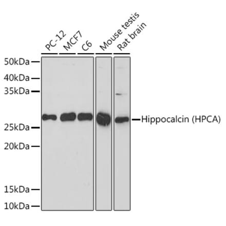 Western Blot - Anti-Hippocalcin Antibody [ARC2235] (A307363) - Antibodies.com
