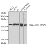 Western Blot - Anti-Hippocalcin Antibody [ARC2235] (A307363) - Antibodies.com