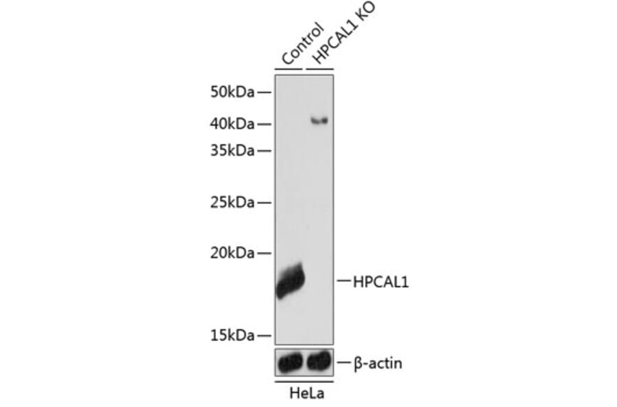 Western Blot - Anti-VILIP3 Antibody (A307364) - Antibodies.com