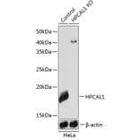 Western Blot - Anti-VILIP3 Antibody (A307364) - Antibodies.com