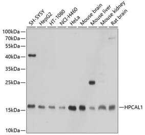 Western Blot - Anti-VILIP3 Antibody (A307365) - Antibodies.com