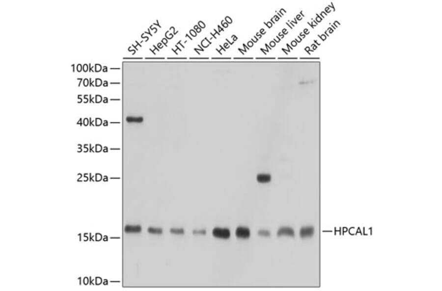 Western Blot - Anti-VILIP3 Antibody (A307365) - Antibodies.com