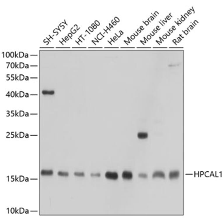 Western Blot - Anti-VILIP3 Antibody (A307365) - Antibodies.com